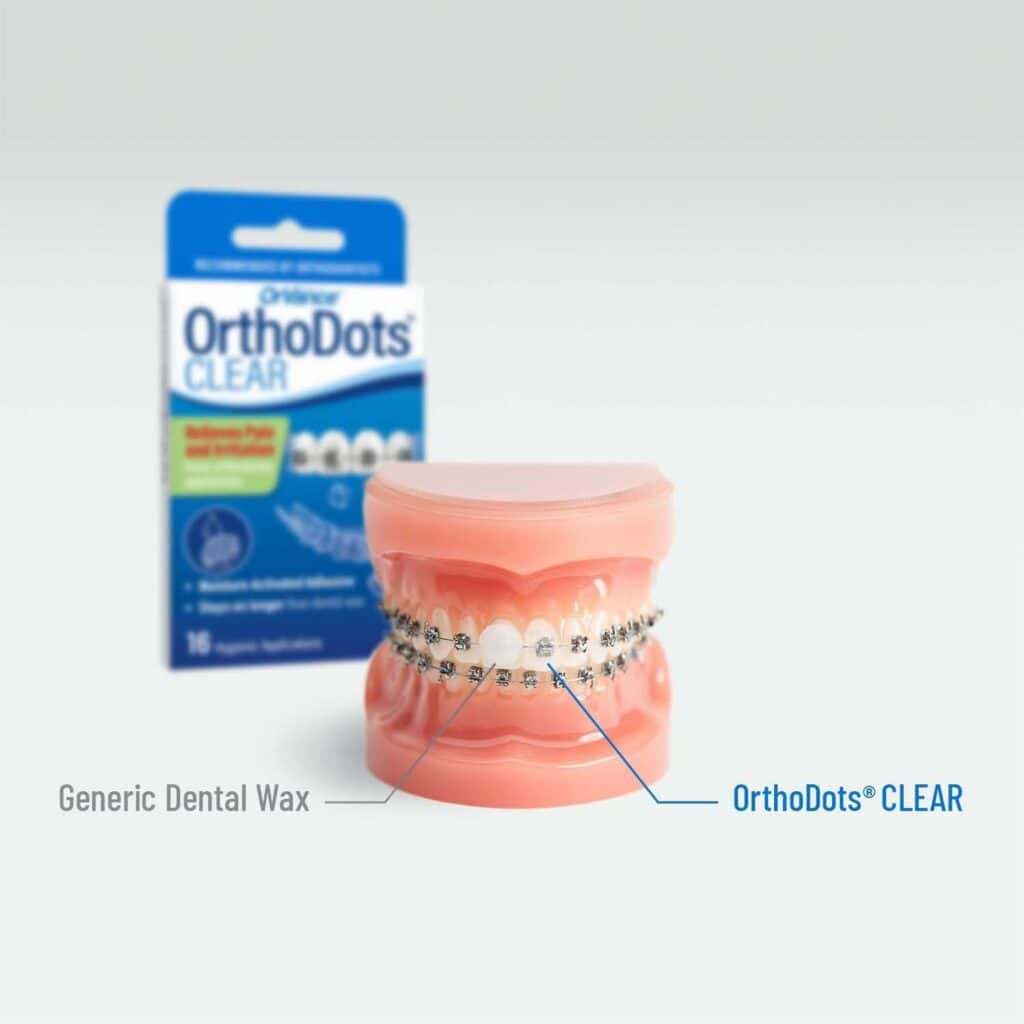 Clear Aligners:Transforming Your Smile in 6Months- ClearRetain Custom Clear Dental Retainers Upper & Lower Retainers