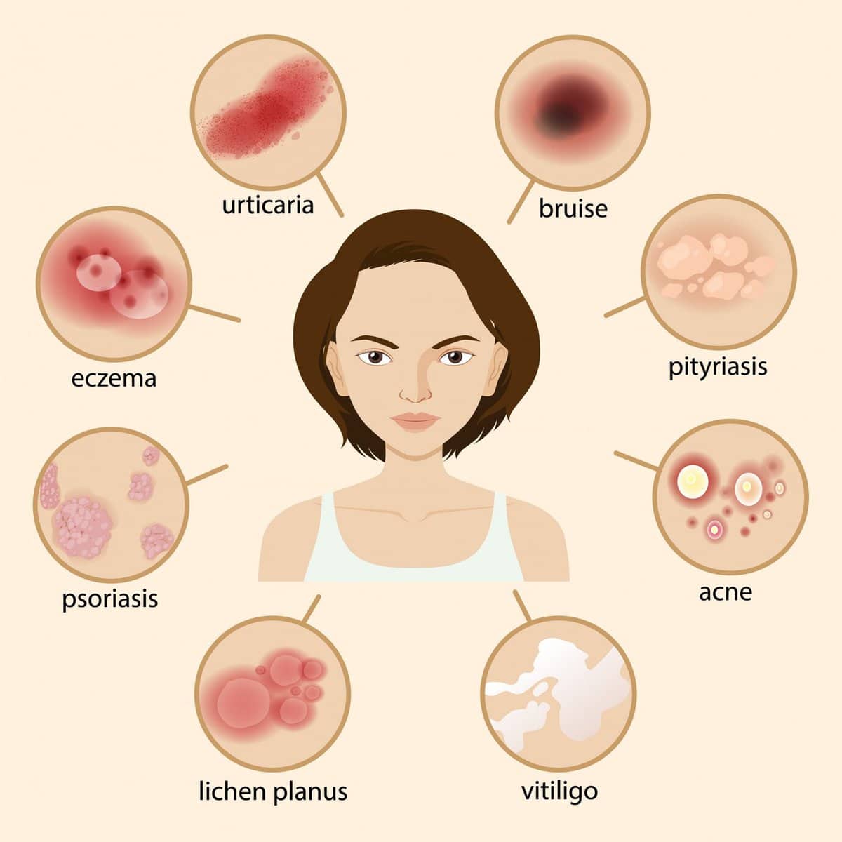 Hormones on Skin